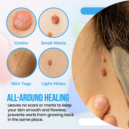 Herbal Extract Warts Clear Dot Stickers