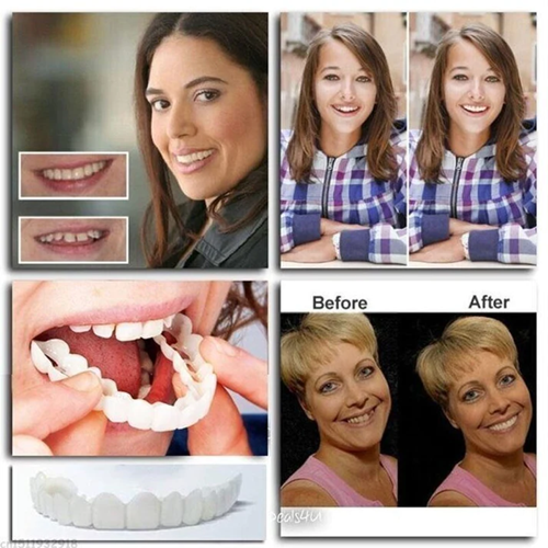 Seurico™ Adjustable 6th Generation Snap-On Dentures