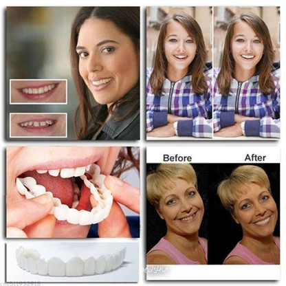 Seurico™ Adjustable 6th Generation Snap-On Dentures