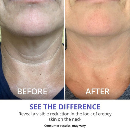 ⏰Last Day Sale 60% OFF💕Natural™ Tighten & Lift Firming Neck Cream for Crepey Skin